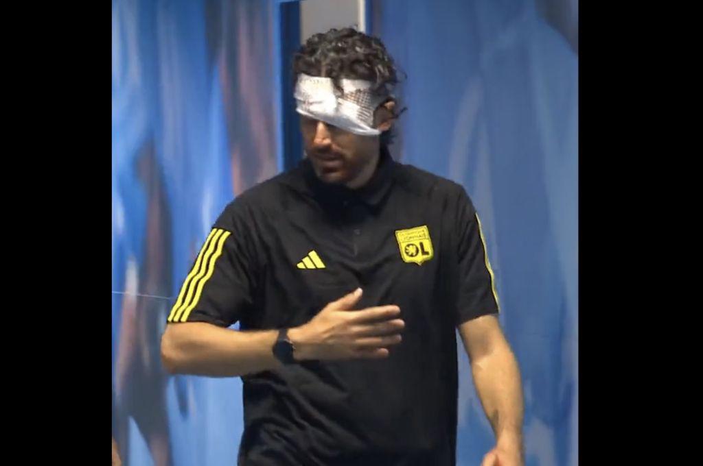 Le destrozaron la cara al entrenador del Lyon: hinchas de Marsella apedrearon el bus y esta ha sido la decisión de la Ligue 1