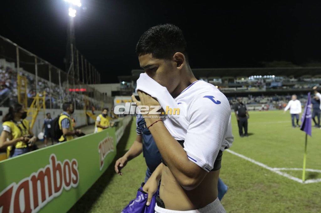 No se vio en TV: Las duras imágenes de los jugadores de Honduras, Luis Alvarado destrozado y el gesto de los estadounidenses