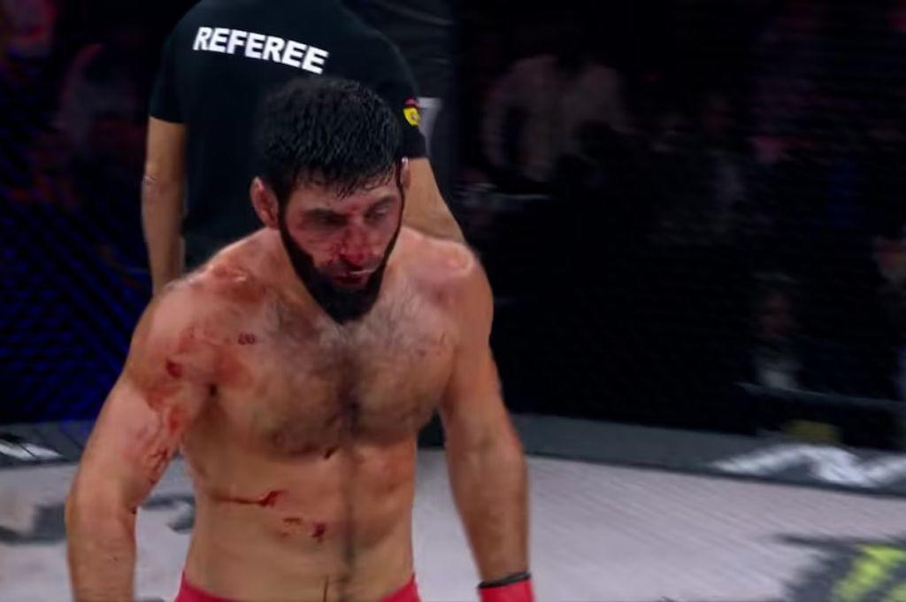 Imágenes sensibles: pelea que promocionó la leyenda Cristiano Ronaldo sale mal: Es inaceptable, no debería volver