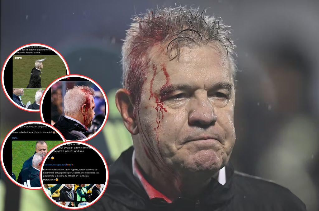 “Acto criminal” “vergonzoso” “aficionado idio**”: la fuerte reacción de la prensa a la agresión de Javier Aguirre