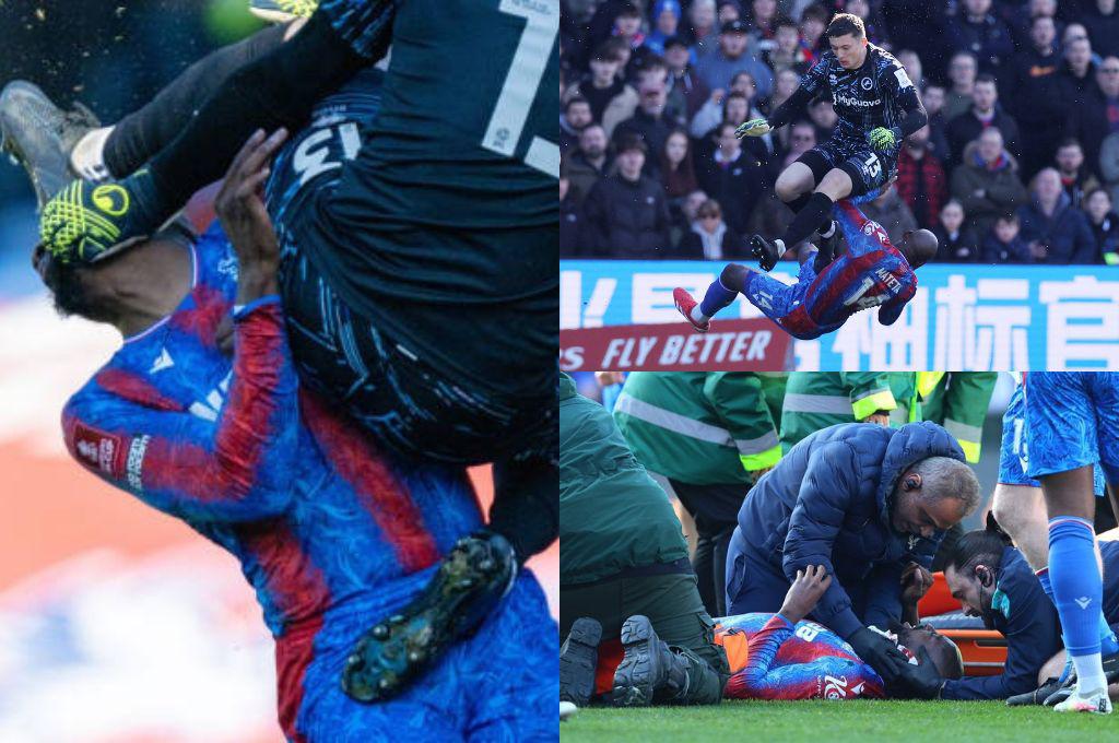 “Déjenlo morir”: sufrió una patada de lucha libre en plena FA Cup, este es su estado de salud y los horribles cantos