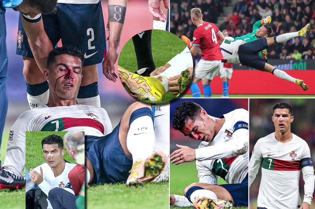 Los checos le dieron con todo: Cristiano Ronaldo sufre durísimo golpe que lo dejó tendido en el suelo y sangrando