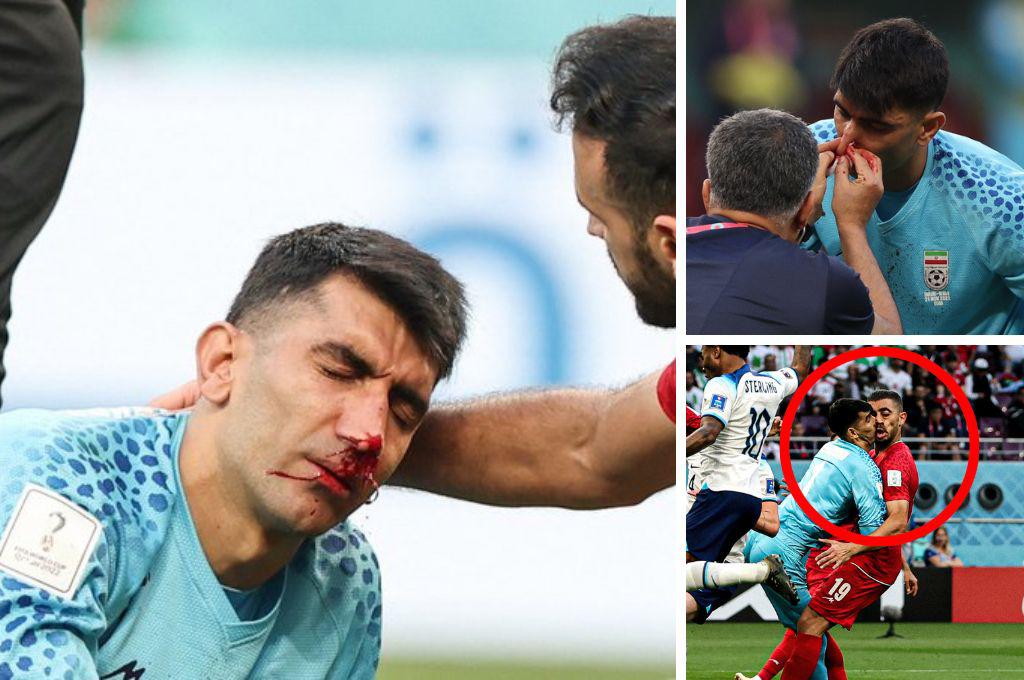 FOTOS: Portero de Irán se fue en camilla luego de recibir terrible golpe de su propio compañero en el Mundial de Qatar 2022