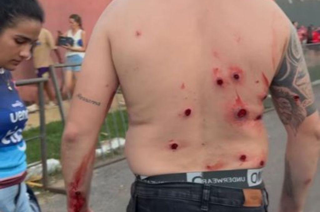 Le dispararon en toda la espalda: así fue el terrible incidente entre la barra y policías en el clásico Olimpia vs Cerro Porteño