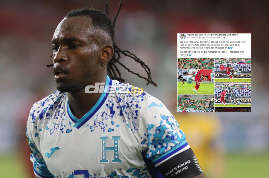 Alberth Elis tras ser operado por una fractura: “Nunca olvidaré el gol que me dejó con un brazo roto”