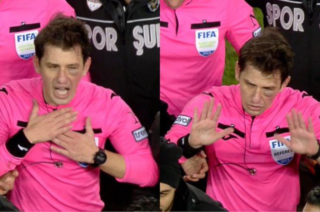 Con el ojo morado y pateado en el suelo: así quedó el árbitro tras ser golpeado por el presidente y jugadores de un equipo turco