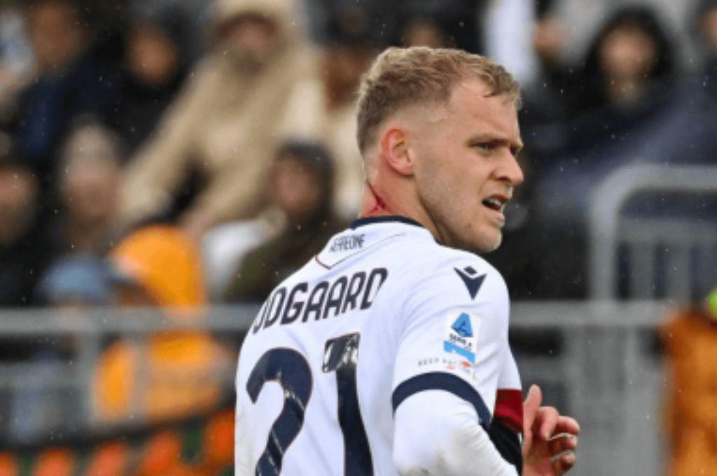 ¿Qué es lo que tiene? la llamativa marca que mostró un futbolista en su cuello y explica todo: Es una mordida zombie”