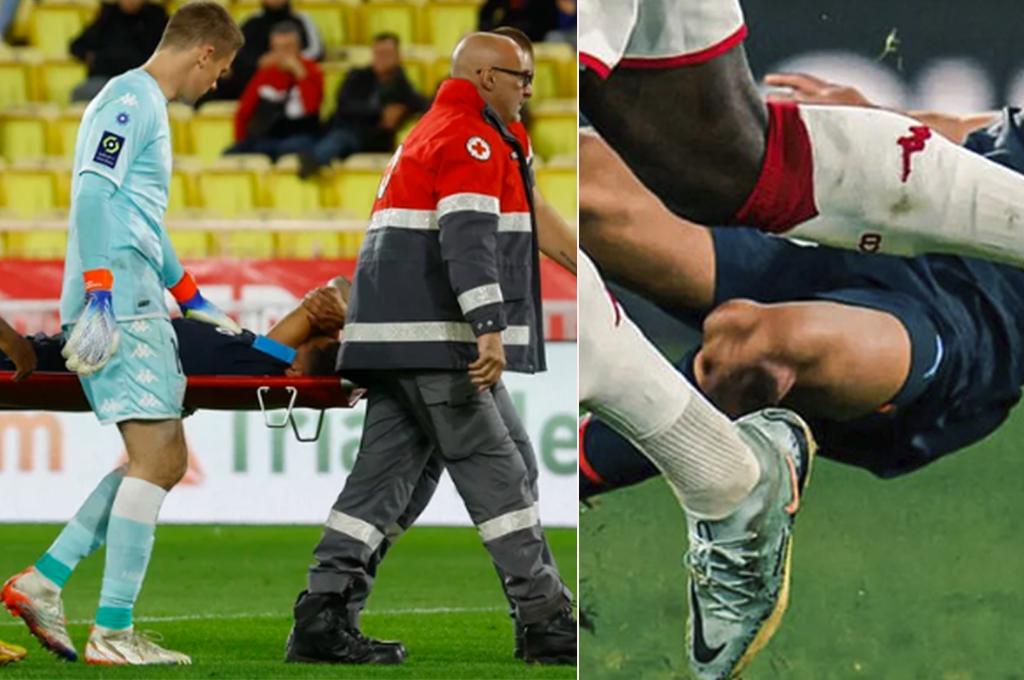 Escalofriante: delantero sufre terrible lesión en Francia que lo deja fuera del Mundial de Qatar