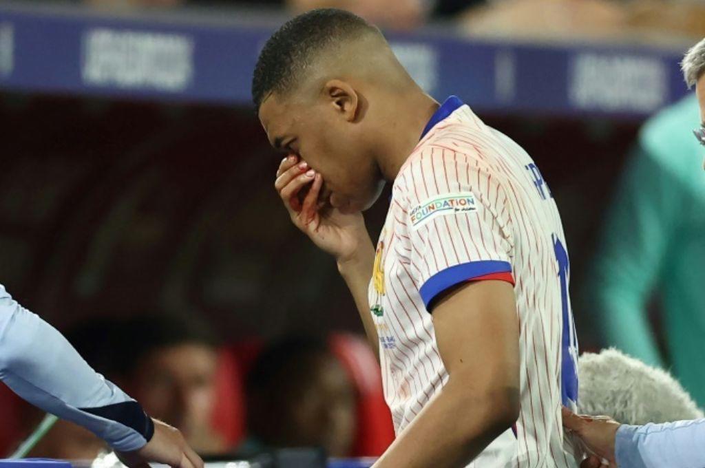 ¿Se pierde el resto de Eurocopa? La decisión que tomó Kylian Mbappé con Francia luego de romperse la nariz
