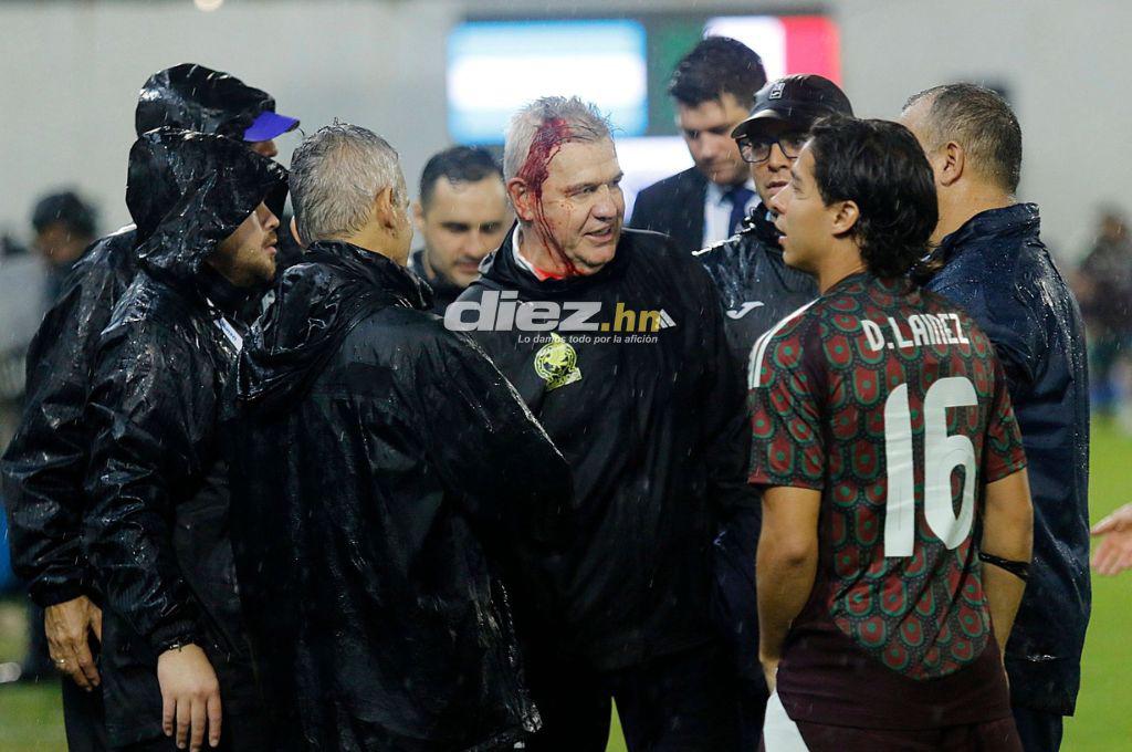 Bronca entre jugadores, el festejo de Honduras tras vencer a México y el feo gesto de Javier Aguirre, quien sufrió un corte en la cabeza