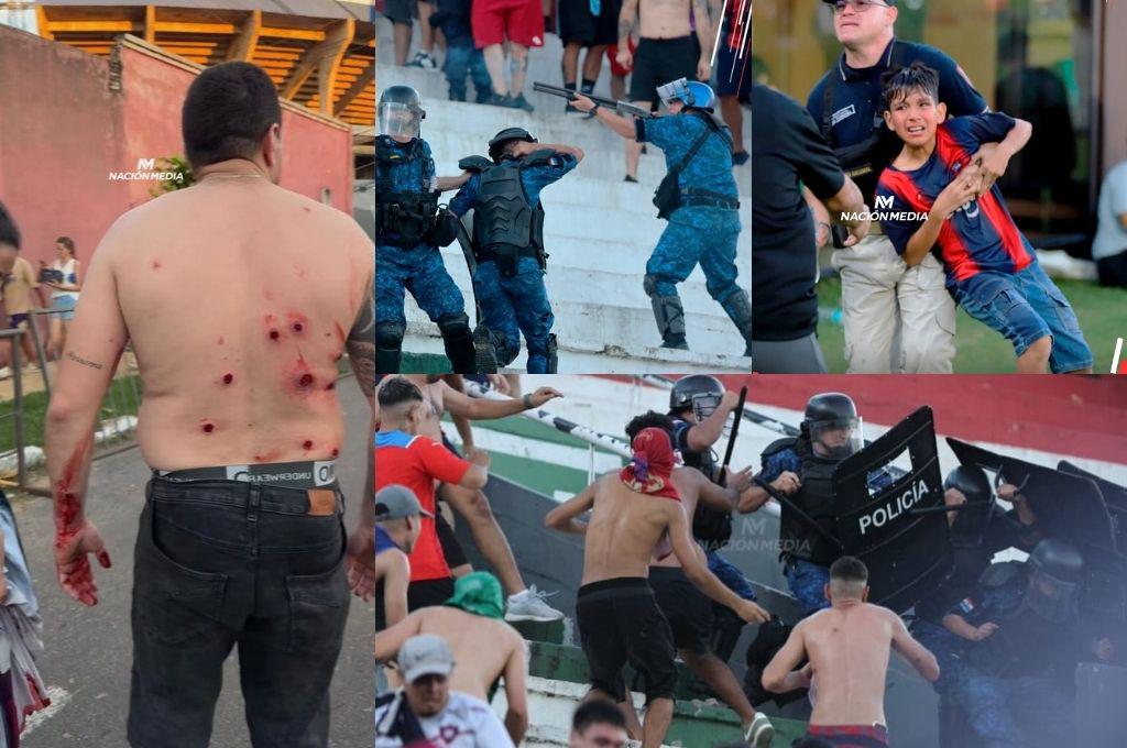 Le dispararon en toda la espalda: así fue el terrible incidente entre la barra y policías en el clásico Olimpia vs Cerro Porteño