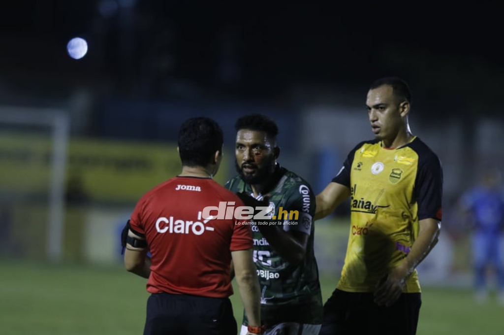 NO SE VIO EN TV: Cortan arito a jugador de Marathón con alicate, la bronca de Mayorquín y el coqueteo de Kevin Álvarez con la hermana de Getsel Montes