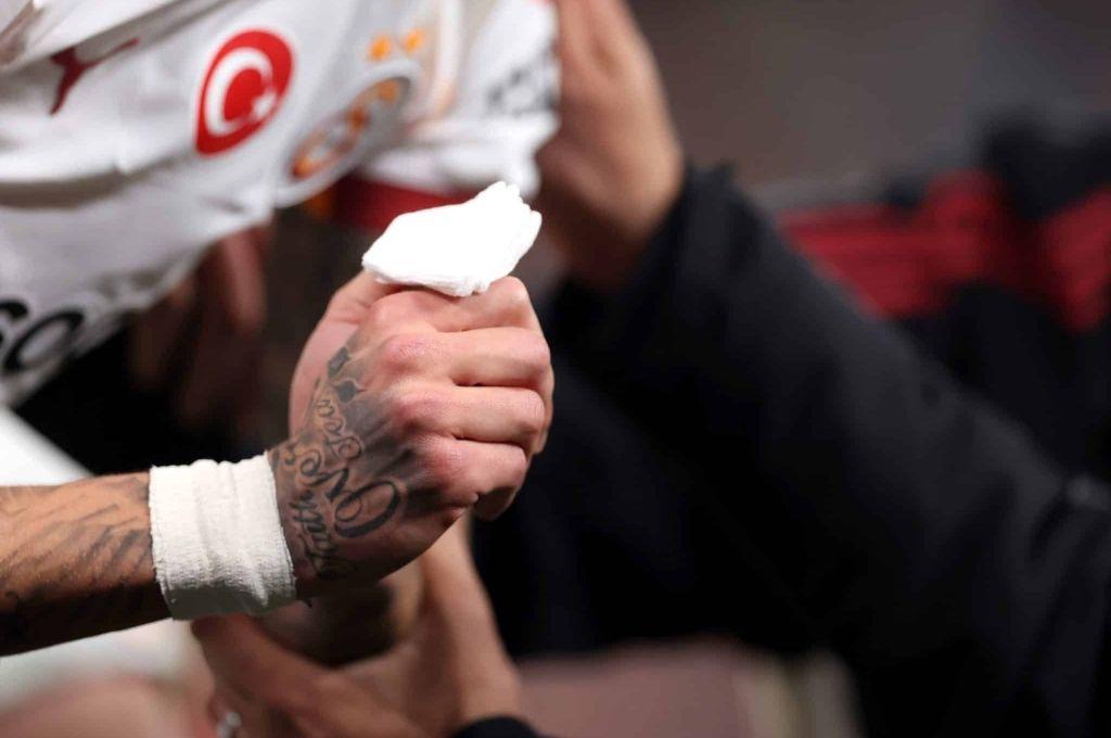 Amputaron su dedo tras ser eliminado de la Champions: la escalofríante imagen que se vivió en Anfield