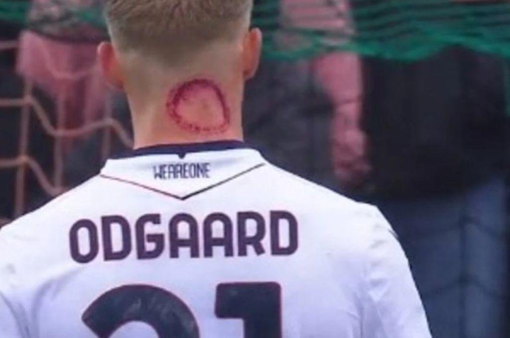 ¿Qué es lo que tiene? la llamativa marca que mostró un futbolista en su cuello y explica todo: Es una mordida zombie”