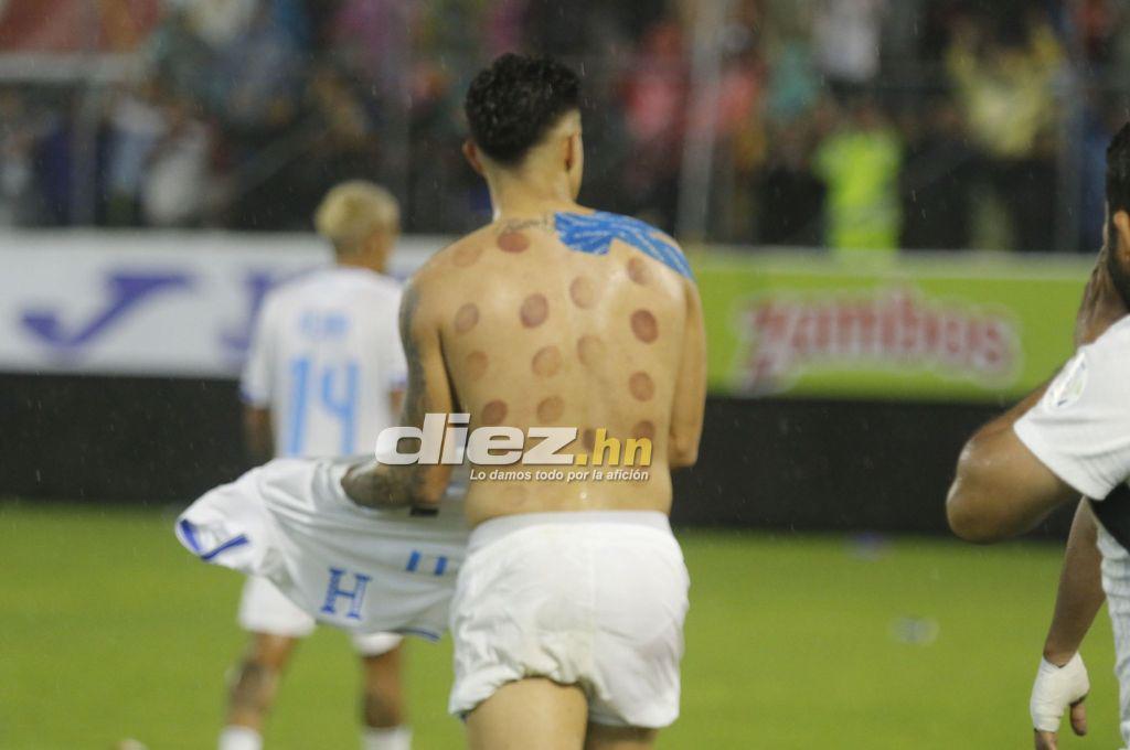 Bronca entre jugadores, el festejo de Honduras tras vencer a México y el feo gesto de Javier Aguirre, quien sufrió un corte en la cabeza