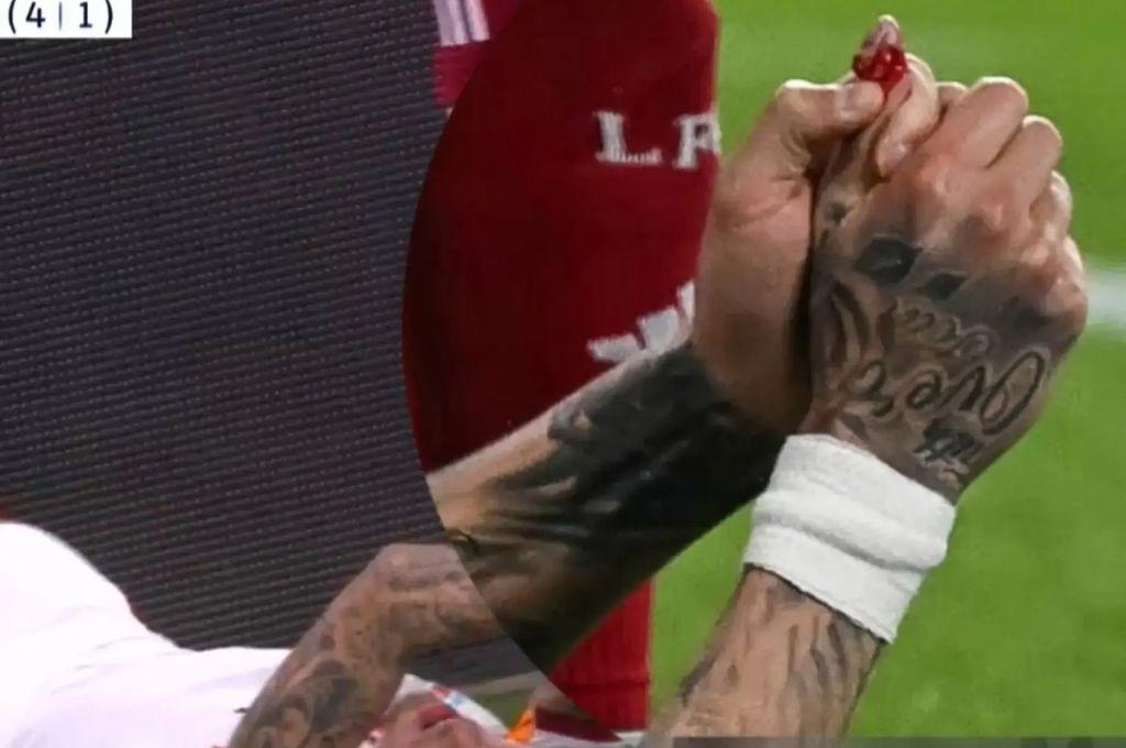 Amputaron su dedo tras ser eliminado de la Champions: la escalofríante imagen que se vivió en Anfield