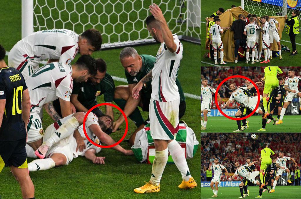 Sensibles imágenes en la Eurocopa 2024: Así quedó jugador de Hungría tras golpe en la cabeza y la lesión que sufre