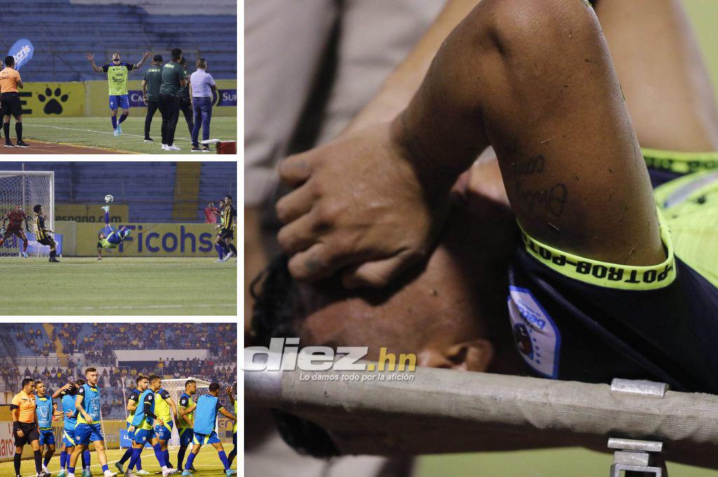 No se vio en TV: El sufrimiento de Mario Martínez, la frustración en Real España y la fiesta de los Potros en el Olímpico