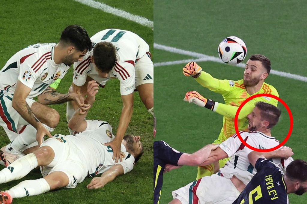 Barnabás Varga y los últimos reportes en la Eurocopa: los médicos dan malas noticias sobre su salud: “Se rompió”