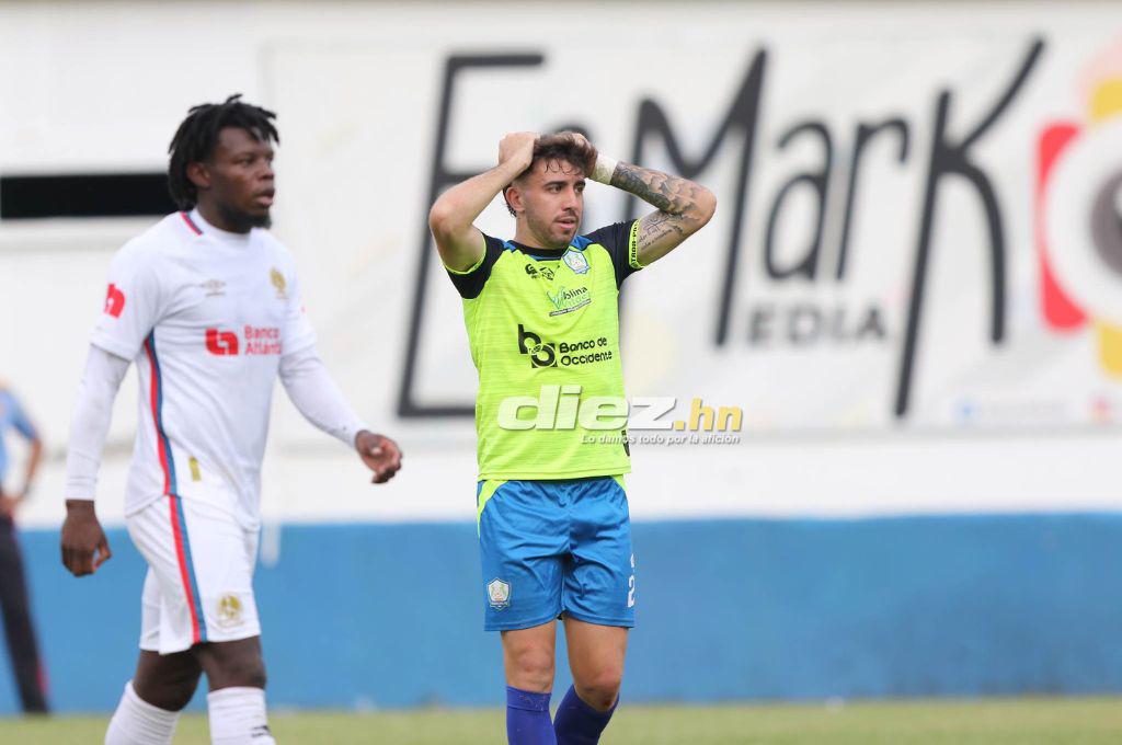 Las otras fotos que dejó la final Potros vs Olimpia: El jugador que se perdería la final de vuelta y la frustración del “Mango” Sánchez