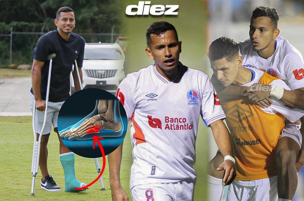 La situación real de la lesión de Edwin Rodríguez: el tiempo que falta para su regreso y lo que confirma el médico de Olimpia