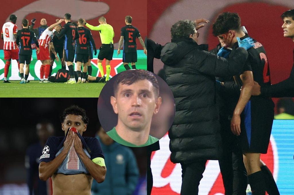 Terrible herida de Cubarsí que terminó con 10 puntos en la cara, crisis en el PSG y el penal más tonto en la historia de la Champions