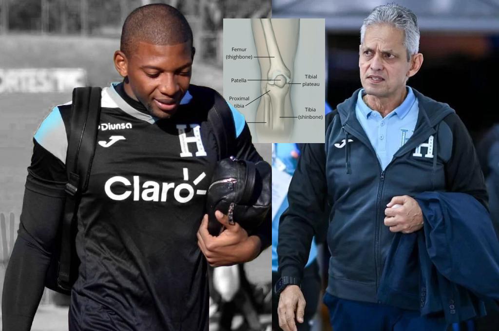 Buba López, en alerta roja para el repechaje ante Costa Rica: expertos evalúan su lesión y revelan tiempo de baja