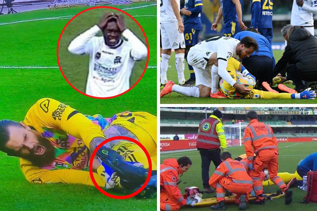 No apto para sensibles: La terrible lesión de tobillo que sufrió jugador de Polonia que se perderá el Mundial de Qatar