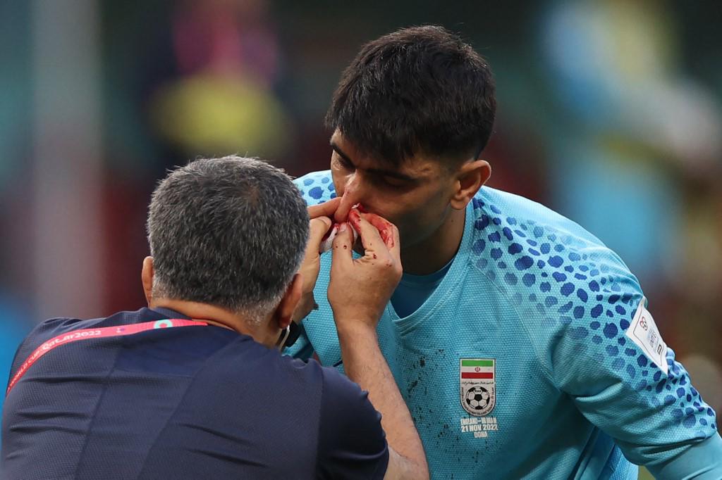 FOTOS: Portero de Irán se fue en camilla luego de recibir terrible golpe de su propio compañero en el Mundial de Qatar 2022