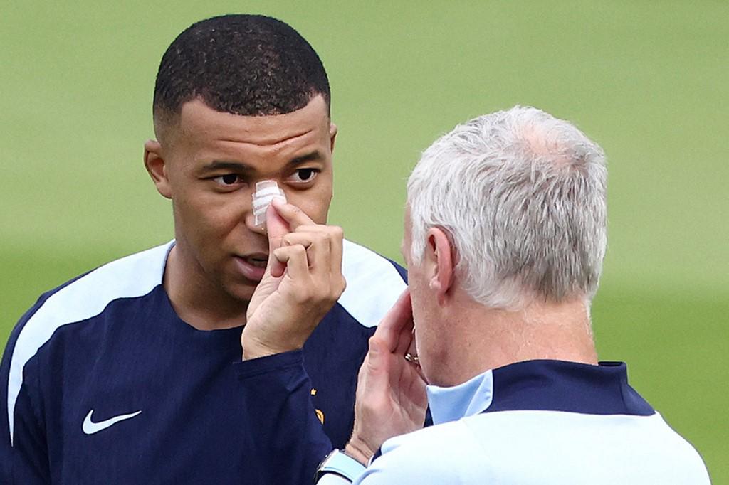 Las primeras fotos de Kylian Mbappé tras fracturarse la nariz en la Eurocopa 2024: el anuncio de su entrenador