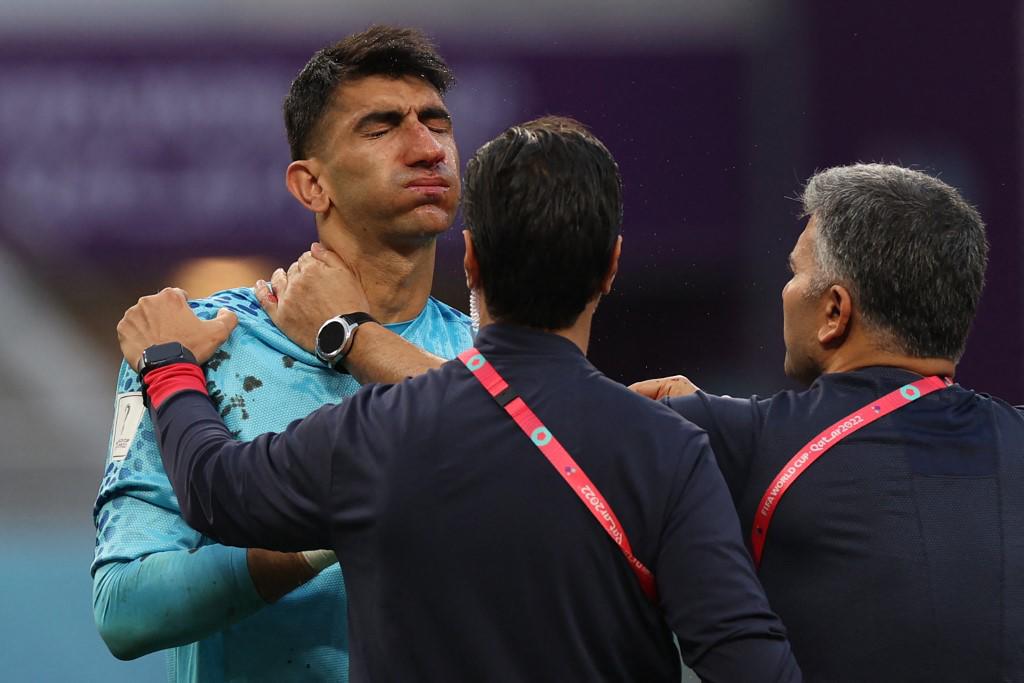 FOTOS: Portero de Irán se fue en camilla luego de recibir terrible golpe de su propio compañero en el Mundial de Qatar 2022