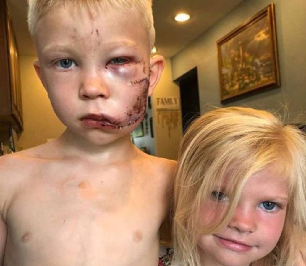 Arriesgó su vida para salvar a su hermana del brutal ataque de un perro y ahora fue reconocido por el Consejo Mundial del Boxeo