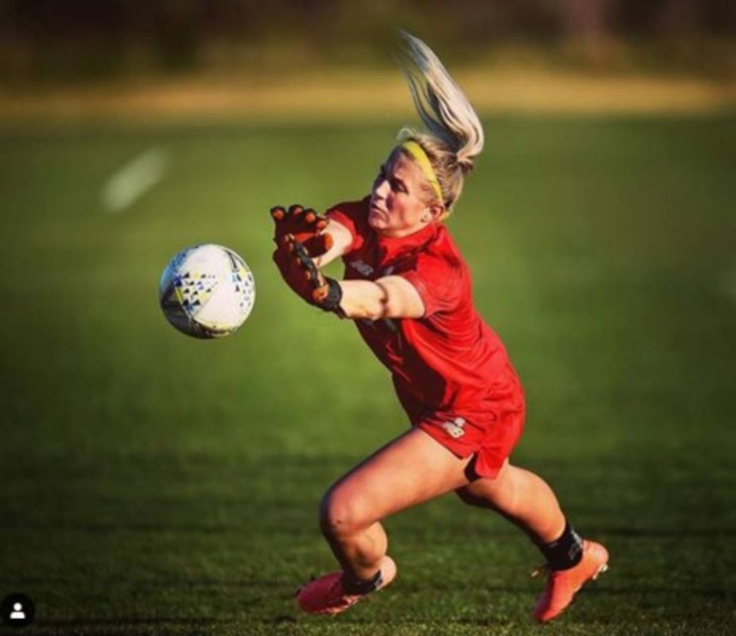 La bella portera del Liverpool sufre un escalofriante corte en la cabeza y muestra su cicatriz