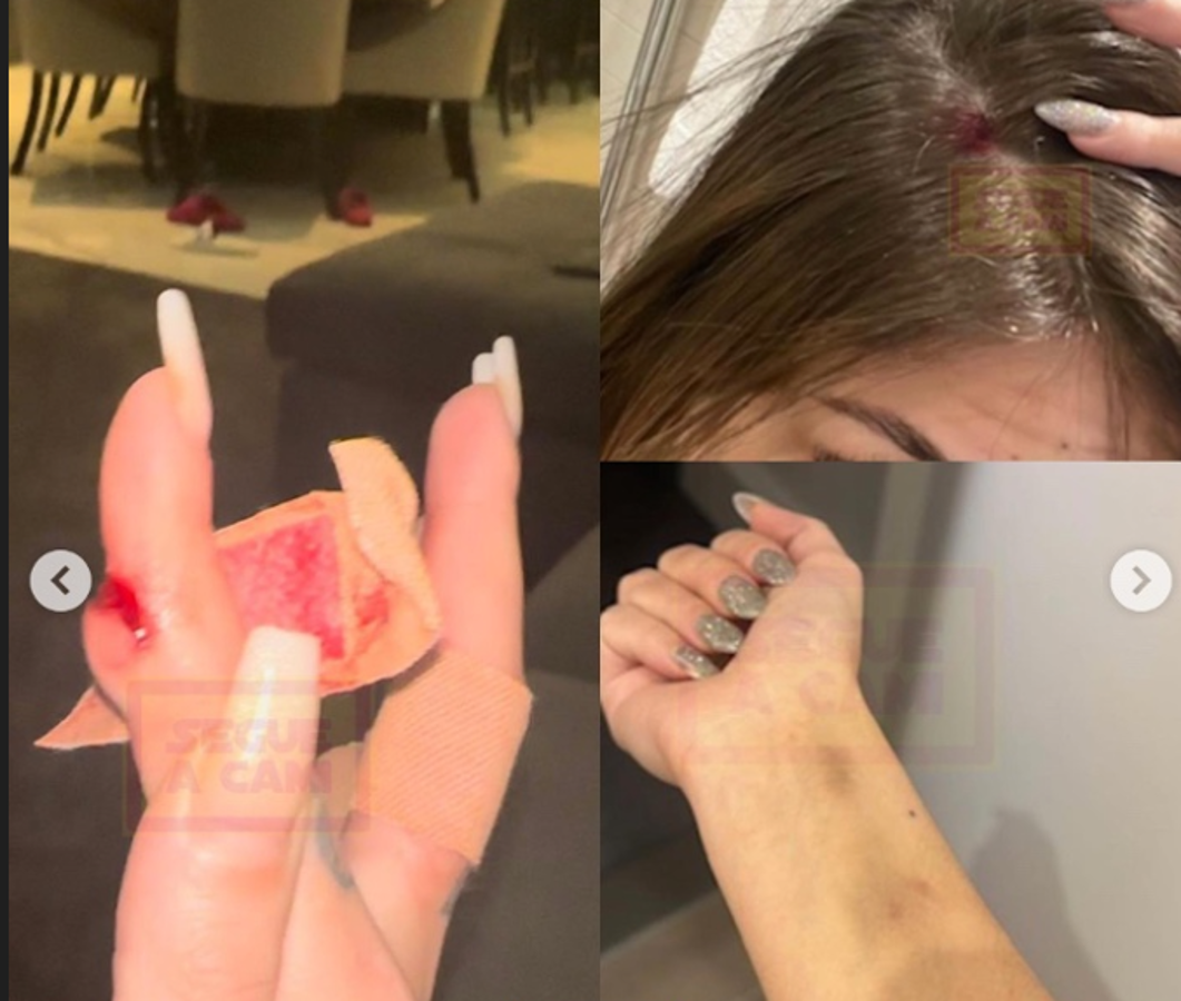 Antony habla tras ser acusado de agresión por su exnovia y la amenaza que recibió: “Me están masacrando...”