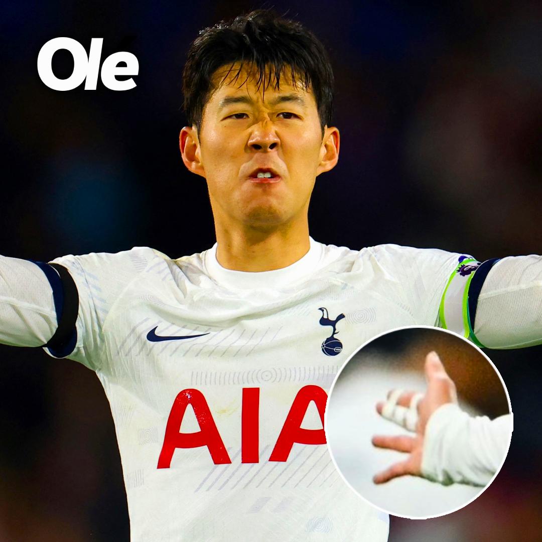 Son Heung-Min sale herido tras una pelea y revelan el insólito motivo del altercado: Así quedó su mano