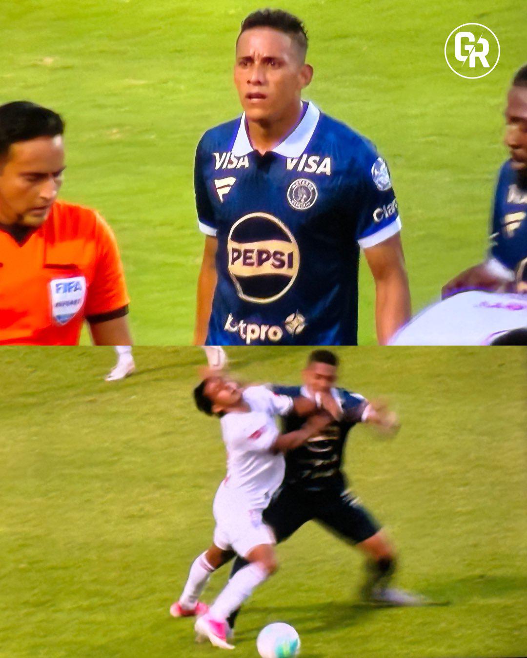 Así quedó el rostro de Edwin tras la agresión, el error y el gesto de Espinel