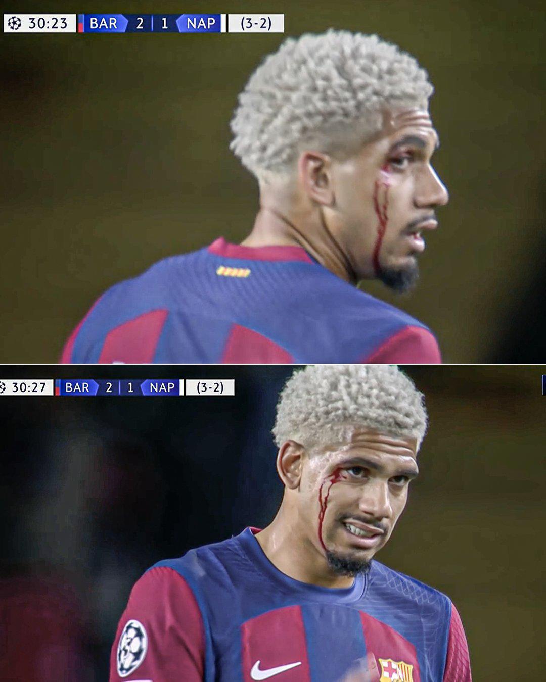 La eufórica celebración del Barcelona y Xavi por volver a cuartos de la Champions y el corte que sufrió Ronald Araújo