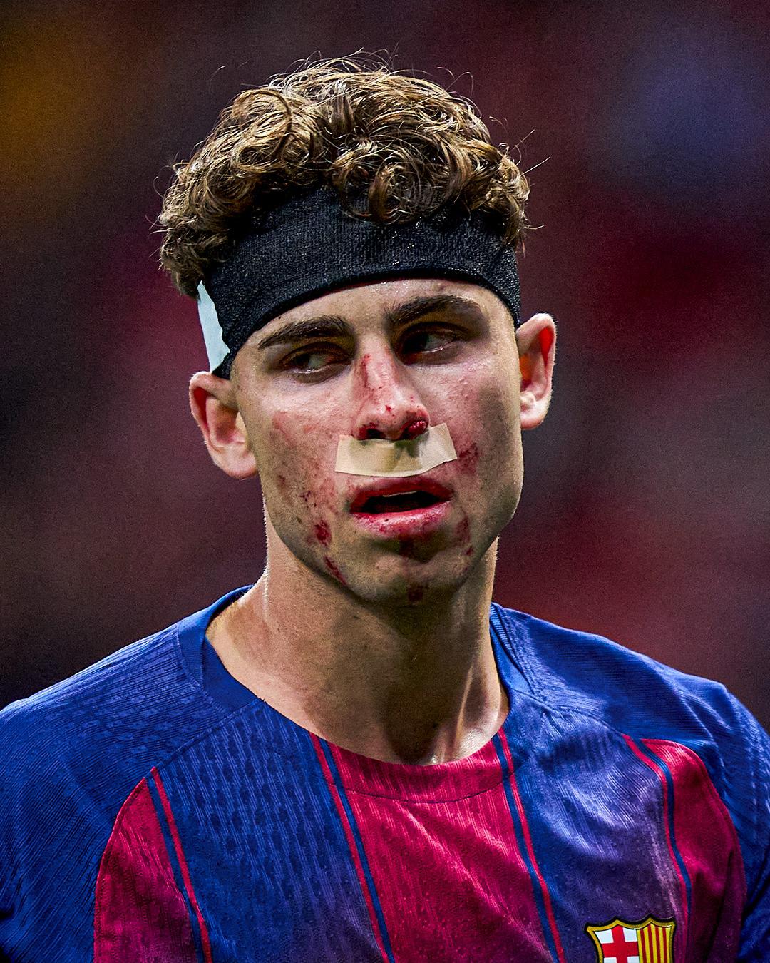 El señalado de la eliminación del Barcelona, así quedó el rostro de Fermín López y la tristeza por otro año sin Champions League