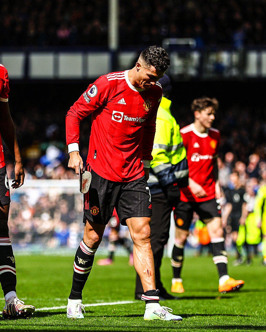 Escalofriante: así le quedó la pierna a Cristiano Ronaldo en la dolorosa derrota del Manchester United