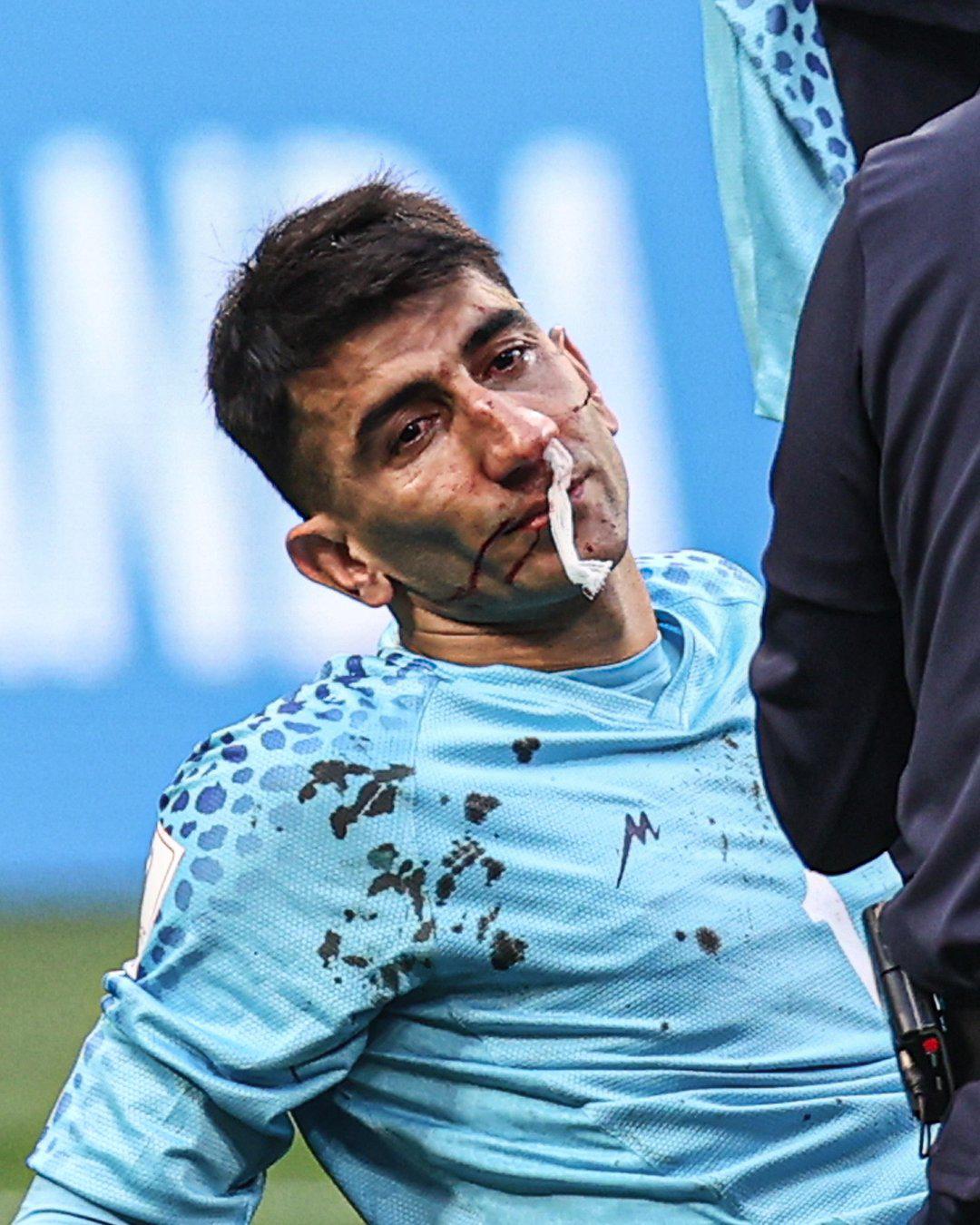 FOTOS: Portero de Irán se fue en camilla luego de recibir terrible golpe de su propio compañero en el Mundial de Qatar 2022