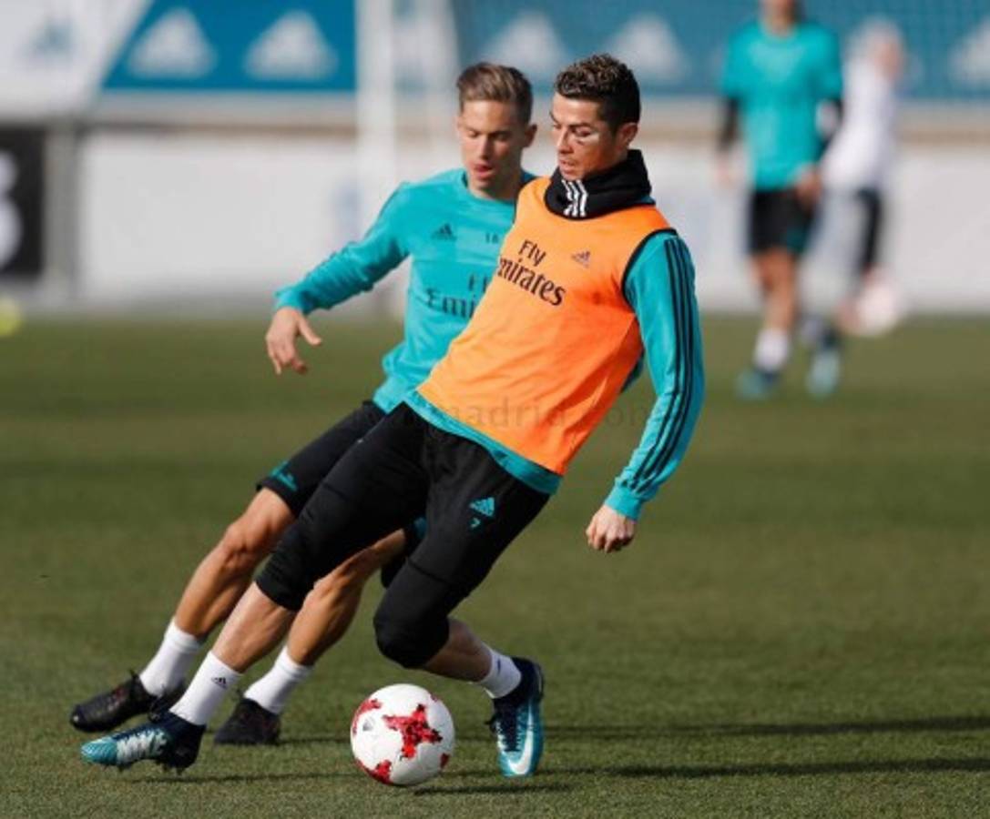 Así luce el rostro de Cristiano Ronaldo dos días después del golpe sufrido ante el Deportivo