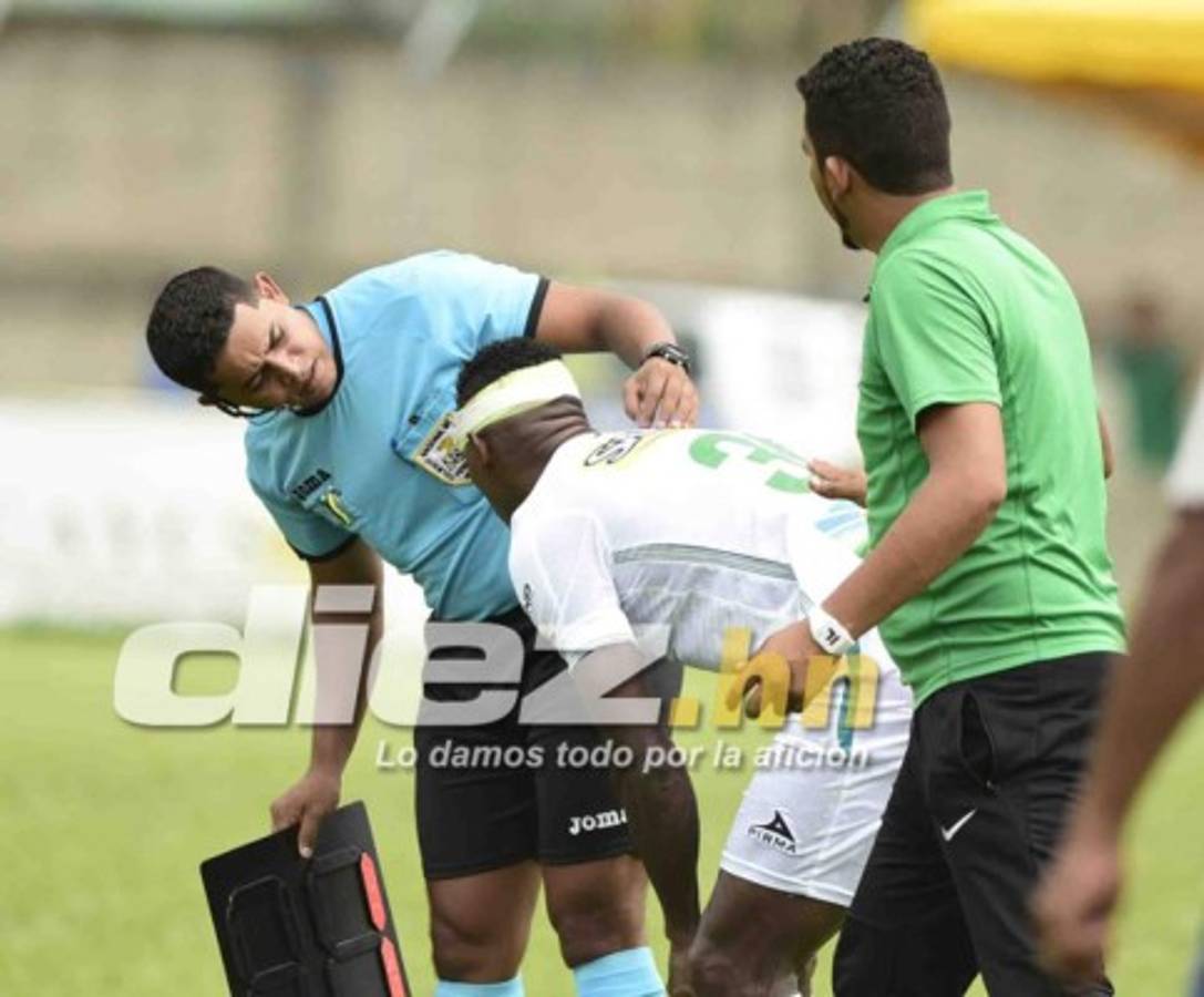 Las imágenes que no se vieron en televisión de la fecha 8 en Honduras