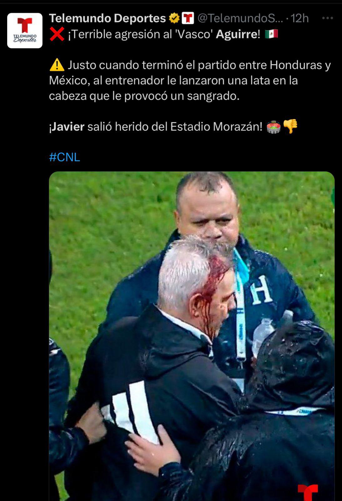 “Acto criminal” “vergonzoso” “aficionado idio**”: la fuerte reacción de la prensa a la agresión de Javier Aguirre