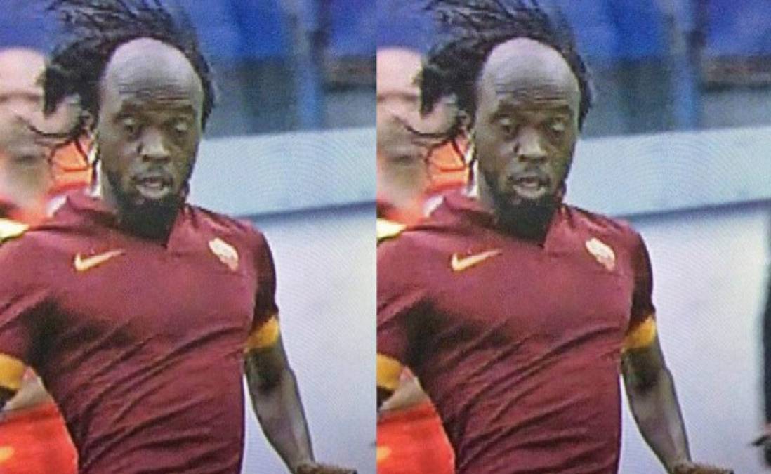 Gervinho y su calvicie, el secreto que salió a luz