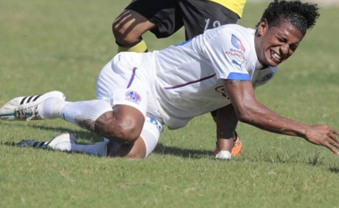 Carlo Costly, lesionado en amistoso de Olimpia ante Juticalpa