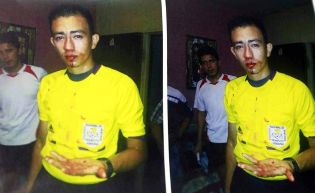 Real Juventud se defendió por agresión a árbitro asistente&nbsp;