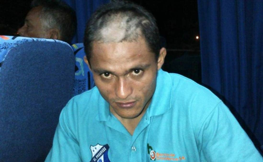 A los debutantes del Honduras Progreso les raparon la cabeza