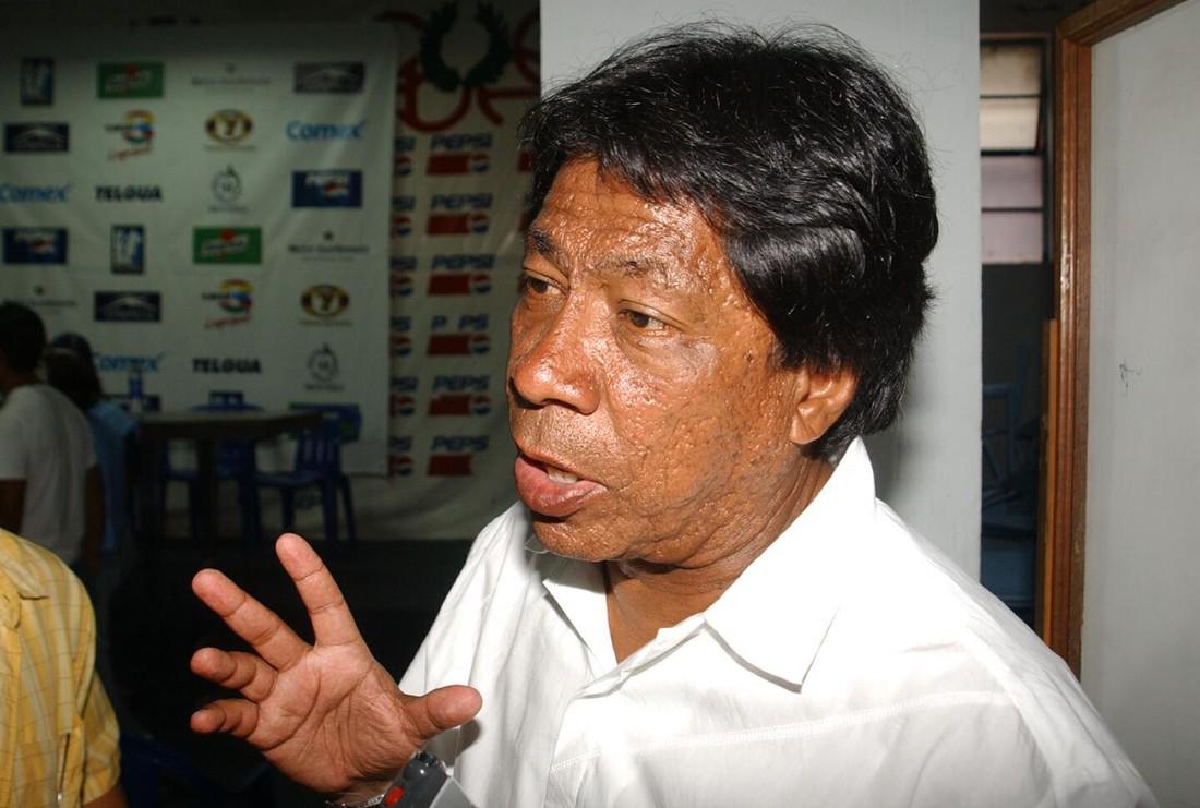 Qué fue de... la Selección de Honduras que venció a la Selección Mexicana en 1996; dos ya fallecieron