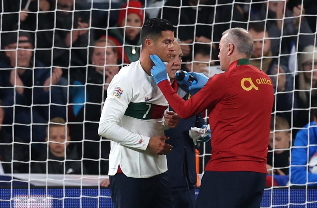 Los checos le dieron con todo: Cristiano Ronaldo sufre durísimo golpe que lo dejó tendido en el suelo y sangrando