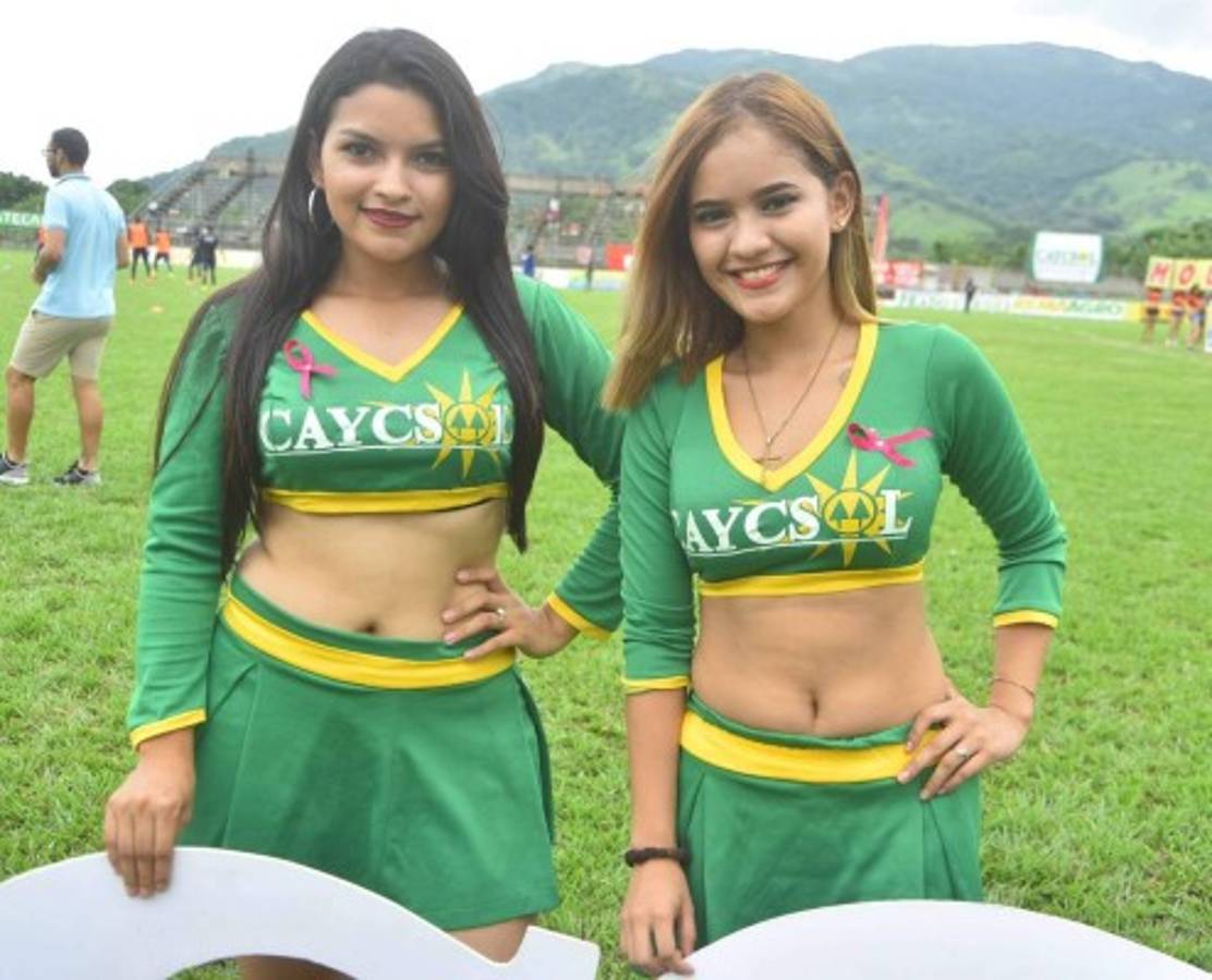 ¡ESPECTACULARES! Las chicas que robaron suspiros en la jornada 10 de Liga Nacional